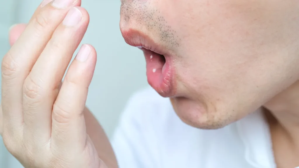 o que é bom para tirar mau hálito de cigarro? o que é bom para tirar mau hálito de cigarro?